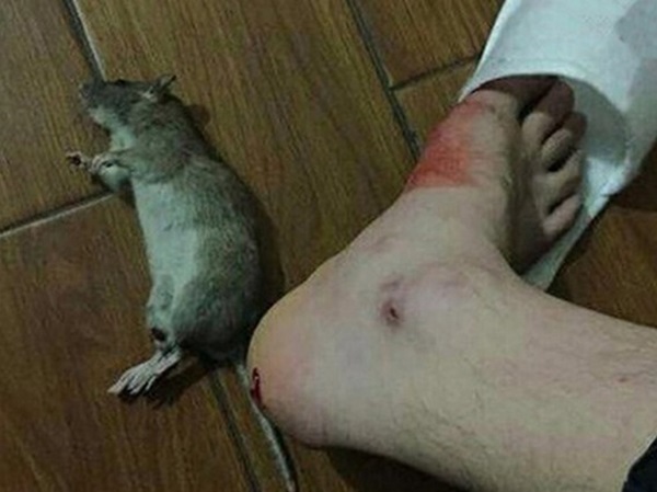 Mơ thấy bị chuột cắn cảnh báo trước điềm gì?